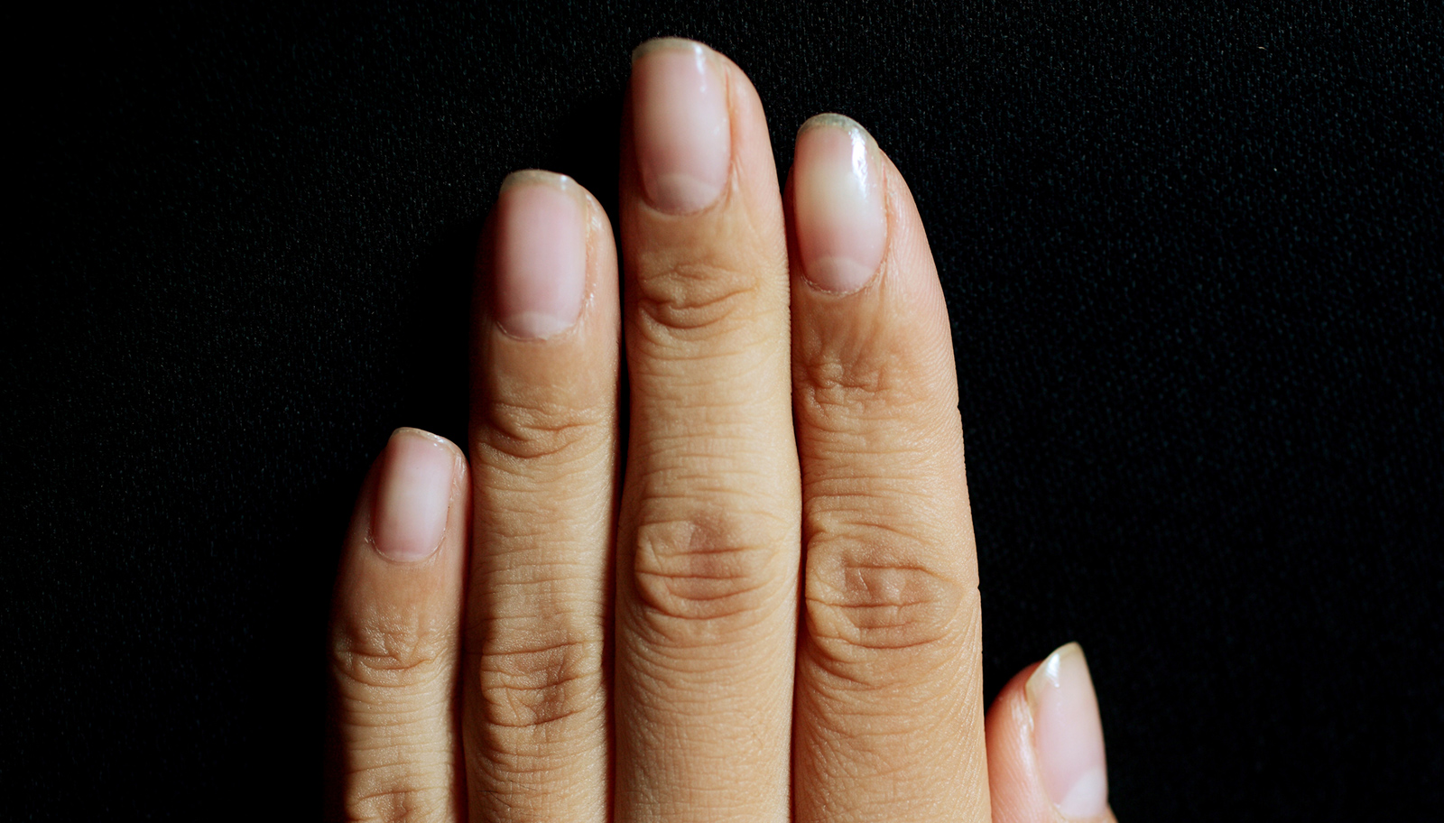 Checking your nails could save your life AOL Features