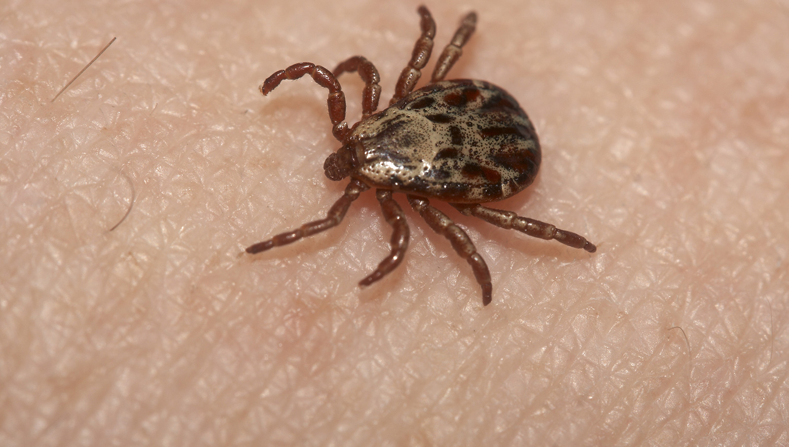 best way to remove a tick from a the best way to remove a tick aol features best way to remove a tick from a the best way to remove a tick aol features